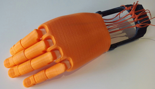 Protesis de mano impresa en 3D - ejemplo medico